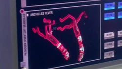 AnchillesFeverPathogen
