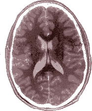 User-FastFission-brain-frame44