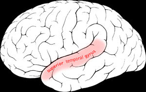 Superior temporal gyrus