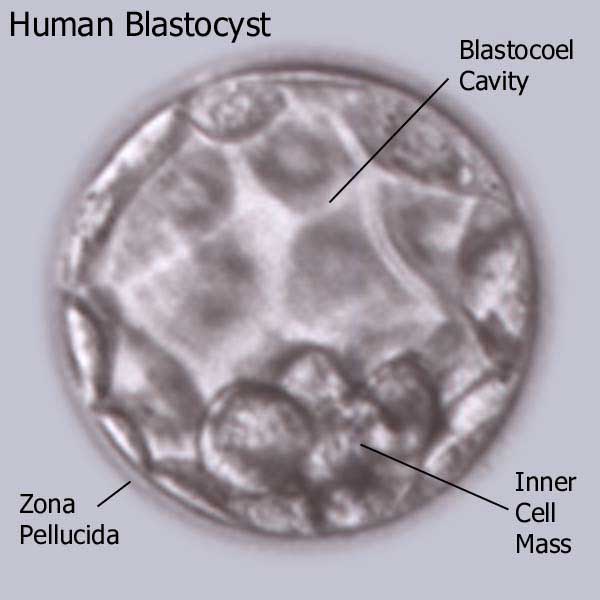 stem cell blastocyst