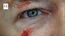 1X04 LockeEye.jpg