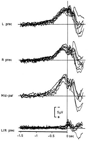 Bereitschaftspotenzial fig1