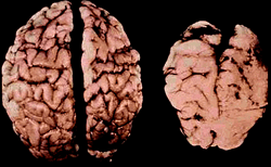 FASbrains2