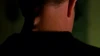 Knowle Rohrer's neck deformity