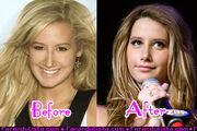 Ashley-tisdale-new-nose-001