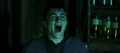 Harry in Pain.jpg
