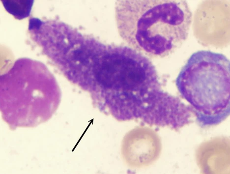 Pathology Outlines - Mast cells