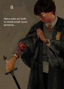 Harry's wound because of the bite of Slytherin's Basilisk 01