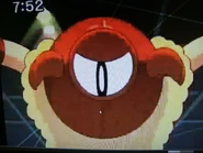 Eye