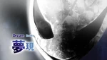 Ep1 title