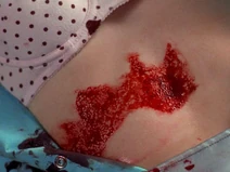 Healing2