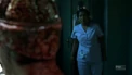 Lobotomy