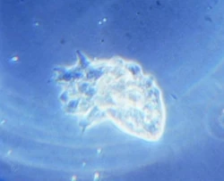 Amoebe