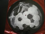 BTW-Boxset-V11