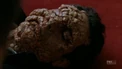 Deadman