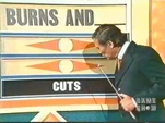 Mgburnsandcuts
