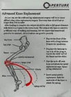 Aperture clipboard Knee