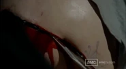 Lori C-section Death