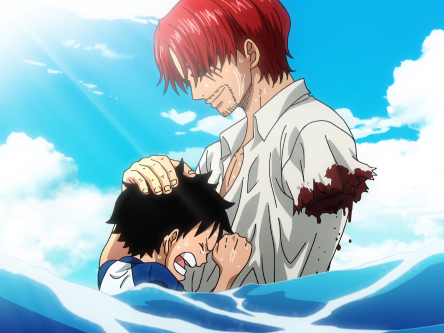 Do you think Shanks had no choice but to lose his arm Or did he