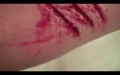 Rake wounds.jpg