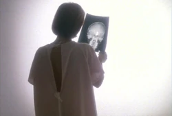 Scully tumor x-ray light Memento Mori
