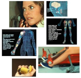 Bionic operation Jaime