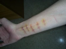 Emo Kid Cut Arm by wickedaemon