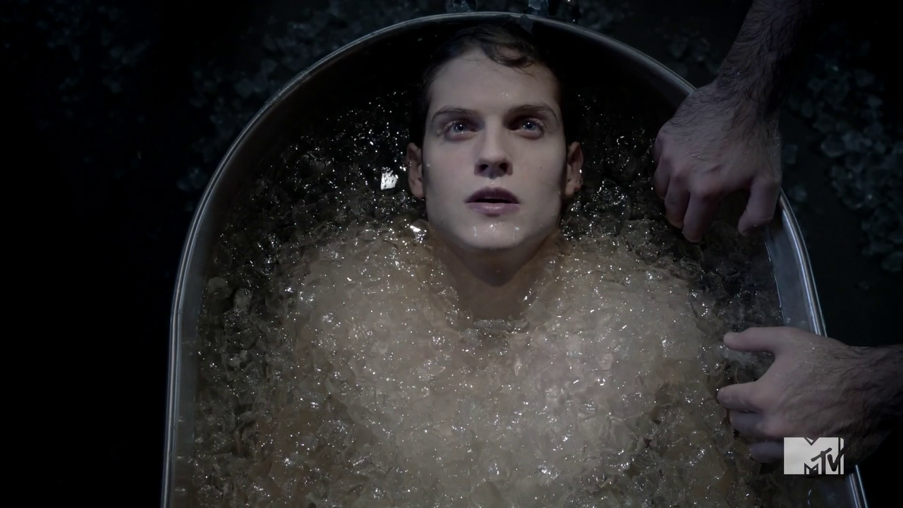 Teen Wolf - Season 3 HDTV COMPLETE torrent on isoHunt