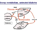 Hyperglycemia