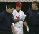 Rowand Breaks His Face