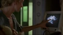 Sun Ultrasound.jpg