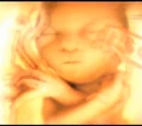 Hope Children