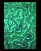 BRAINCORAL