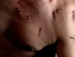 The effects of cybernetic bleed-back.