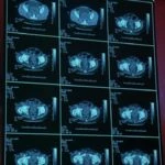 Bild des CT scans.