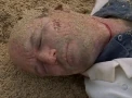 Ray (doctor)#En la isla