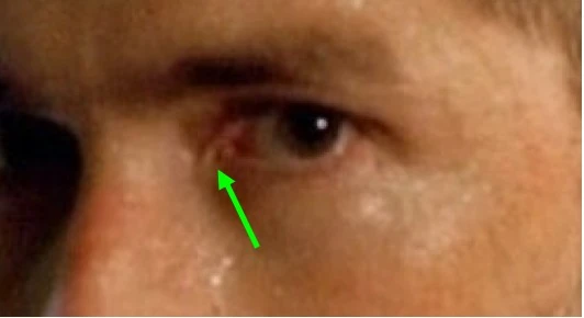 Image:Jack_eye_comparison.jpg