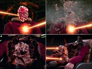 Skin vaporization and internal organ explosion