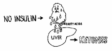When there's not enough insulin to allow conversion of glucose to energy, the body begins to break down fat cells, which produce fatty acids. These fatty acids are converted to ketones which can fuel the brain in emergencies.