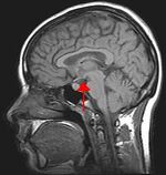 Psychology Biological Basis The Brain | RM. Psychology Biological Basis The Brain | RM.