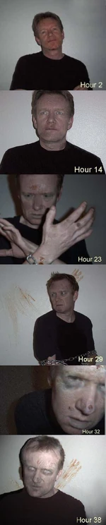 Stages of a necro-mortosis sufferer
